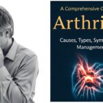 Arthritis: A Comprehensive Guide to Causes, Types, Symptoms, and Management
